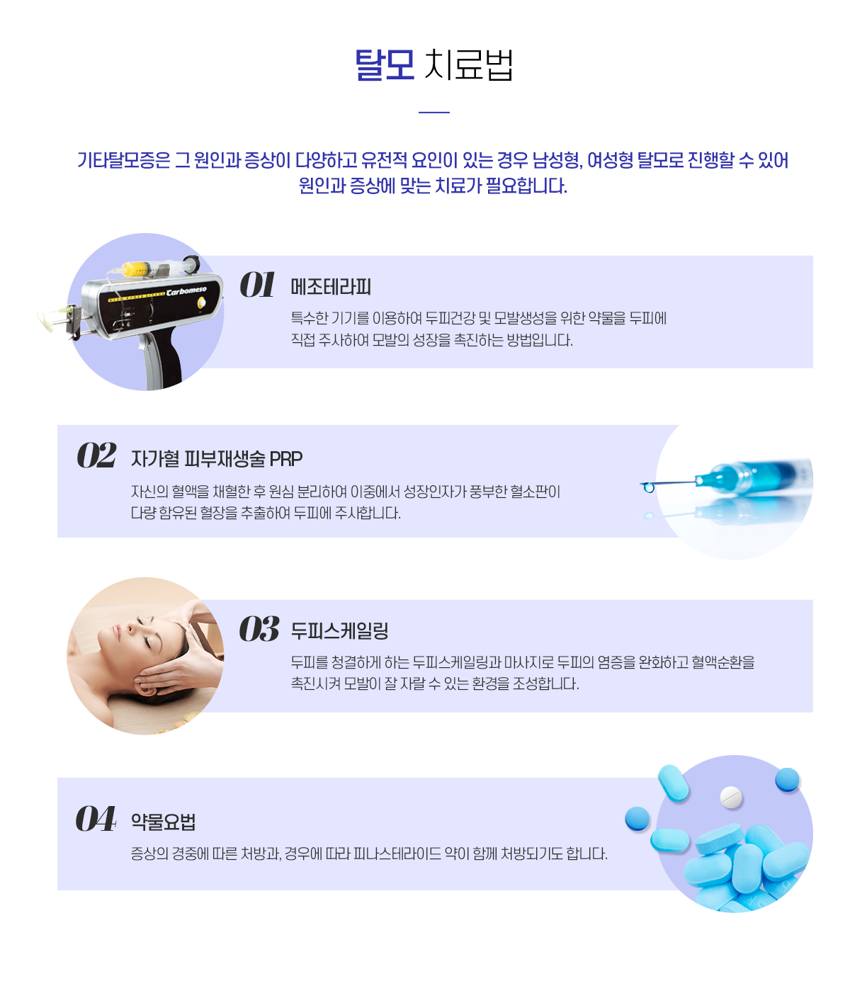 기타탈모의 치료법