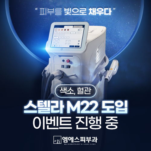 스텔라도입